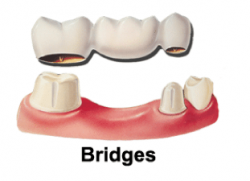Bridges Bridges