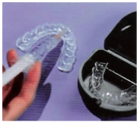 Teeth whitening 2